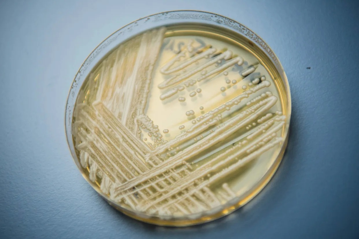 Washington faces first outbreak of a deadly fungal infection that’s on the rise in the U.S.