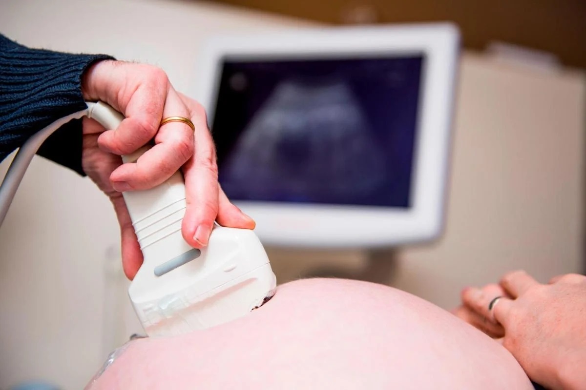Preterm birth rate in the US is rising, study finds, but the reasons are a mystery